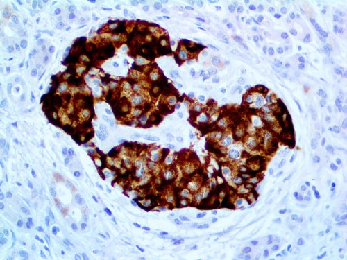 IHC of Insulin on an FFPE Pancreas Tissue